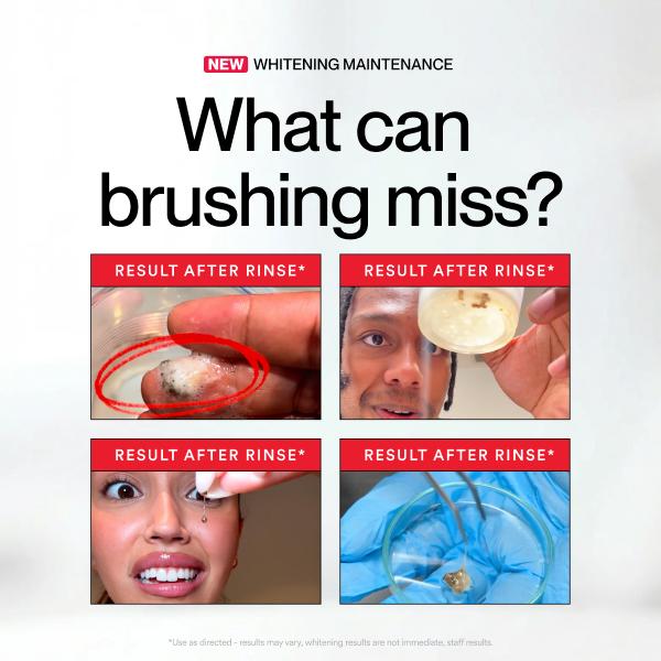Whitening Mouthwash with Essential Oils – Stain Removal, Make teeth white,Fresh Breath-YOY